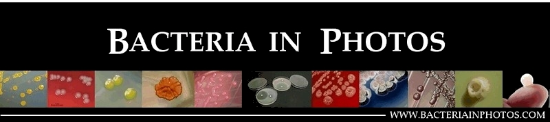 www.bacteriainphotos.com bacteria in photos